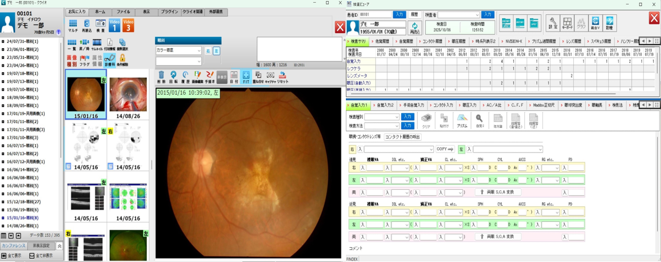 画像ファイリング／ファインデックス／クライオ